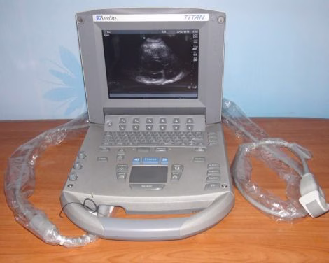 Sonosite Titan
