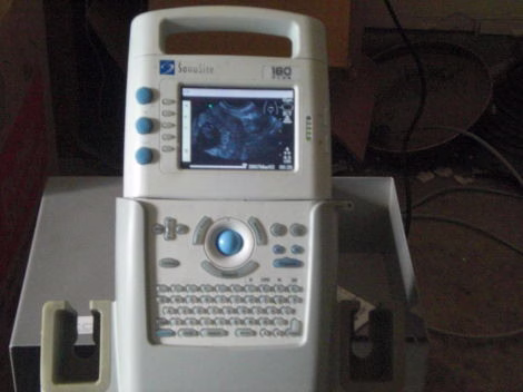 Sonosite 180