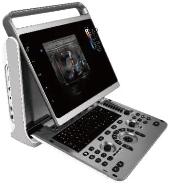 Chison EBit 50
