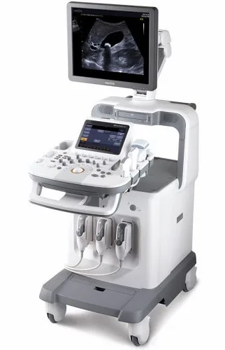 Medison Accuvix V20