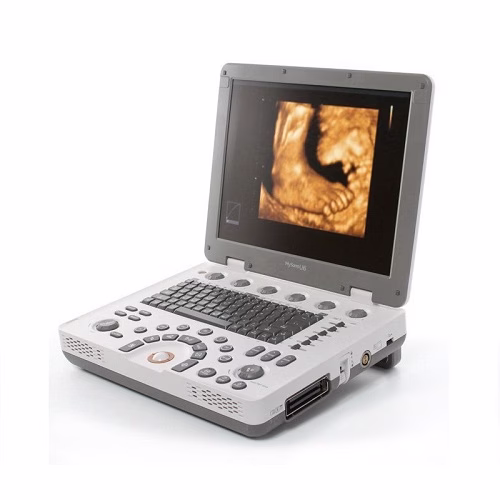 Medison MySono U6