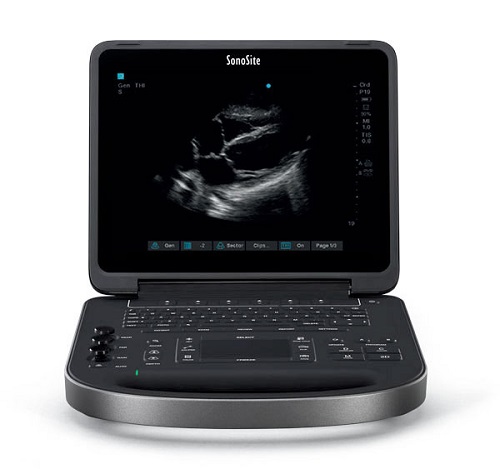 SONOSITE EDGE