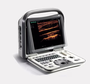 SonoScape A6