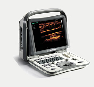 SonoScape A6