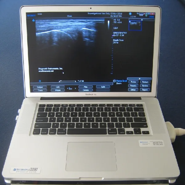 Terason t3200