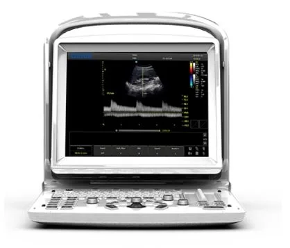 Chison ECO 3