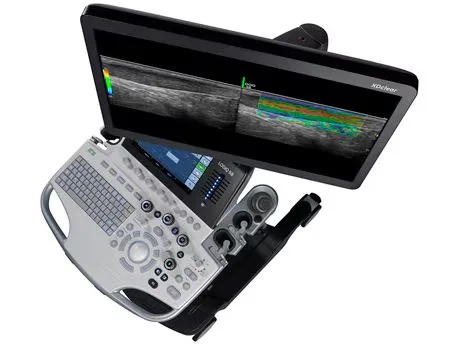 GE LOGIQ S8 R2