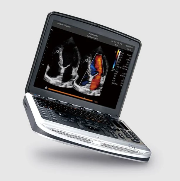 Chison SonoBook 8