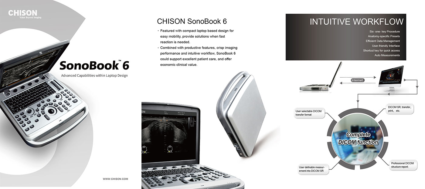 Chison Sonobook 6
