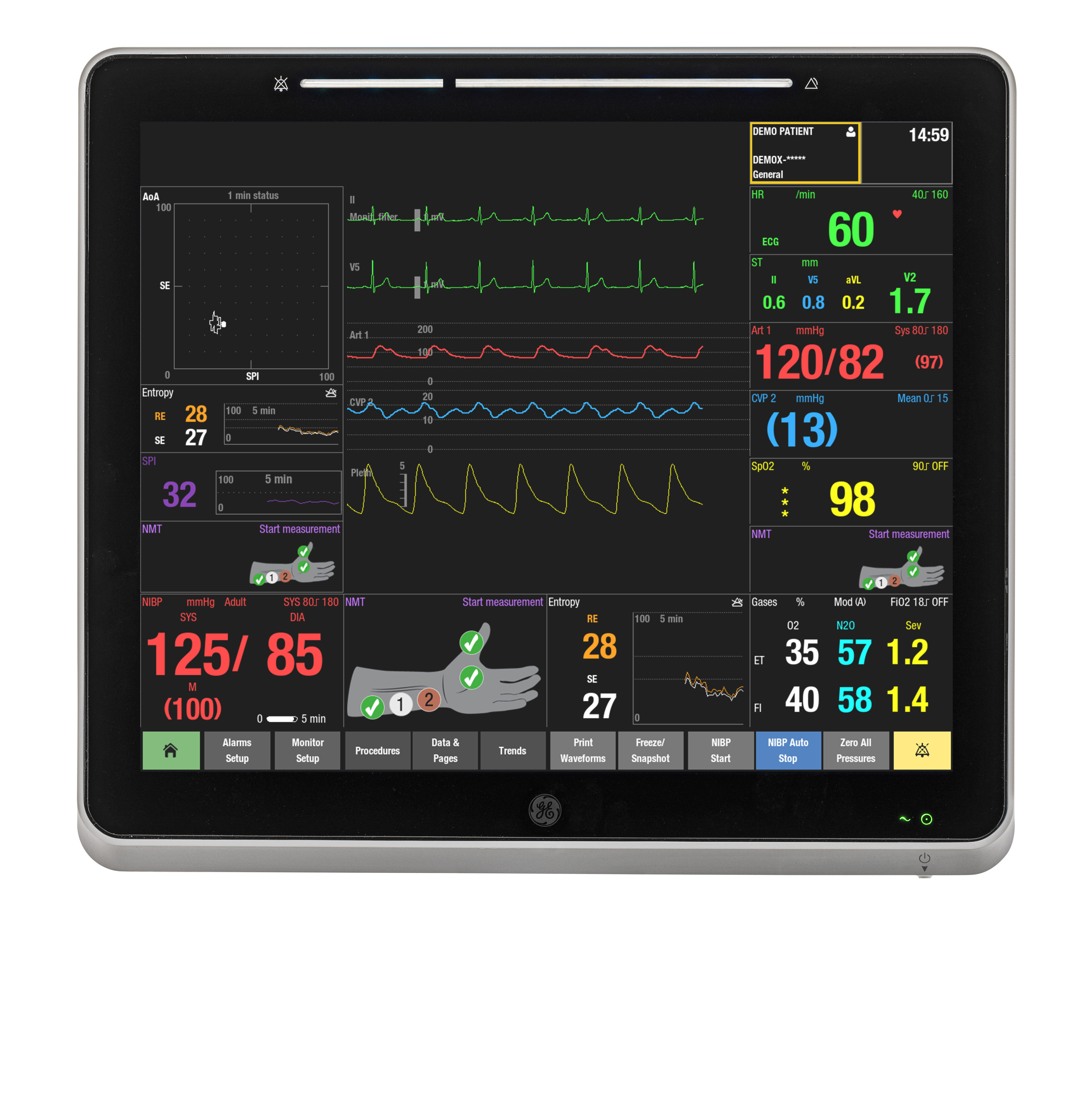 GE HealthCare CARESCAPE Canvas Patient Monitor