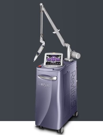 Cynosure ConBio RevLite SI