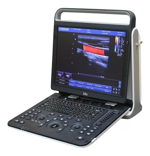 Chison EBit 60