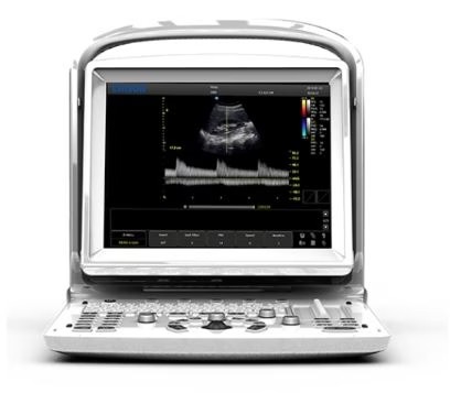 Chison ECO 3