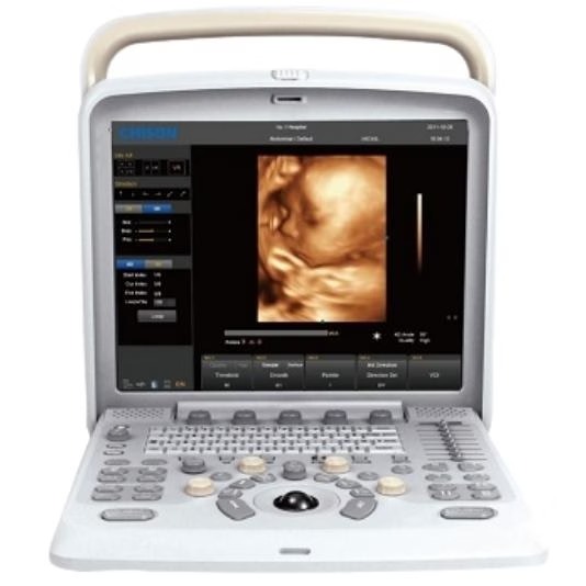 Chison Q5