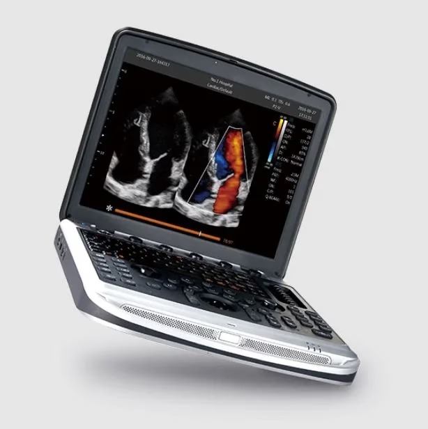 Chison SonoBook 8