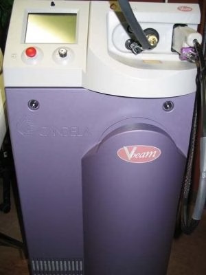 Candela V-Beam