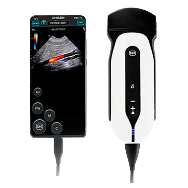 Chison Sonoeye P5