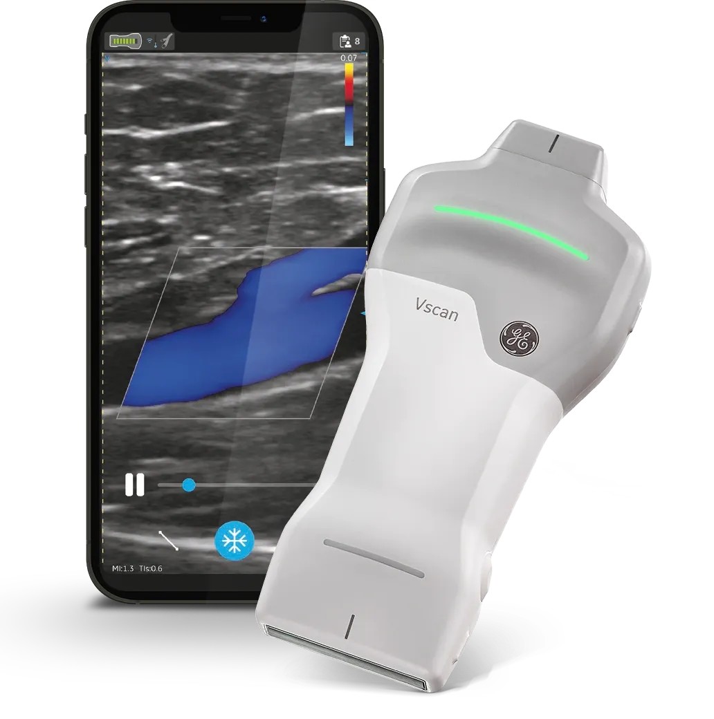 GE HealthCare Vscan Air SL Handheld Ultrasound